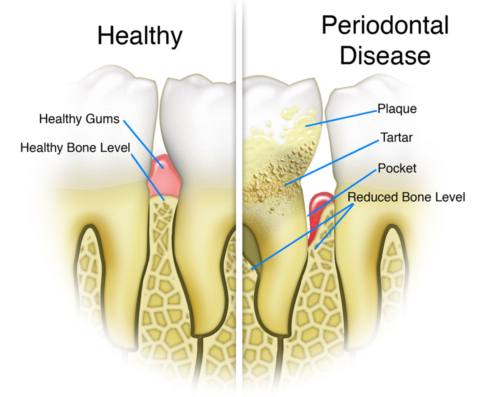 dental clinic in Ashok Vihar. 