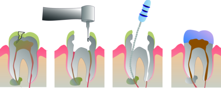 dental clinic in North Delhi