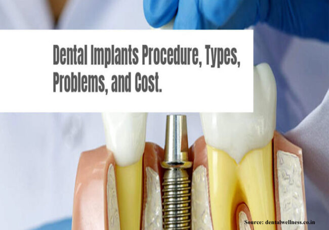 Blog-Image_2-1024×555