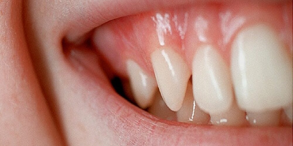650x350_your_mouth_your_health_slideshow