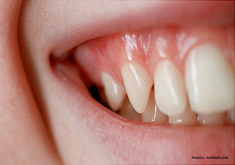 650x350_your_mouth_your_health_slideshow