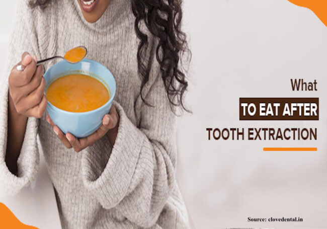 Eat-and-avoid-after-extraction