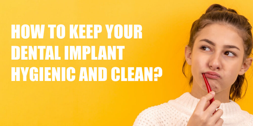 dental-implant