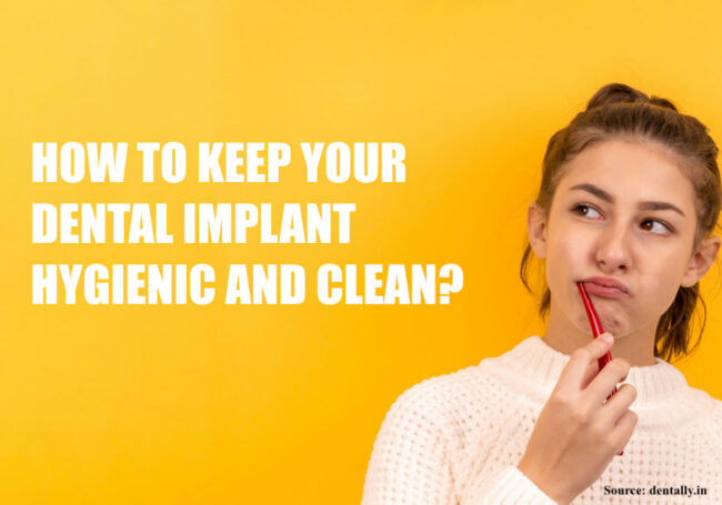 dental-implant