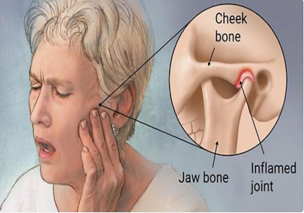 Management Of Temporomandibular Joint Tmj Disorders Dentalimplantindia 