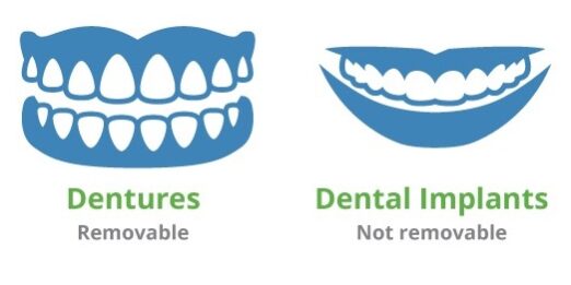 dentures-implants dentures vs dental implants