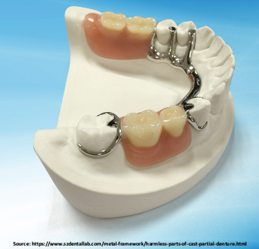 All You Need To Know About Cast Partial Dentures | Dr. Rajat Sachdeva