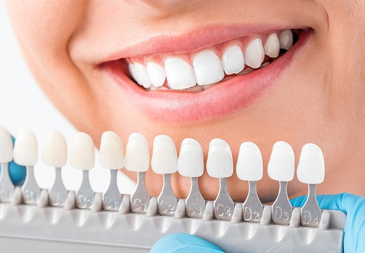 Zirconia Implants Zirconia Implants