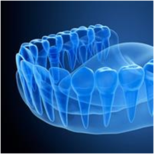 dental-blog-feature